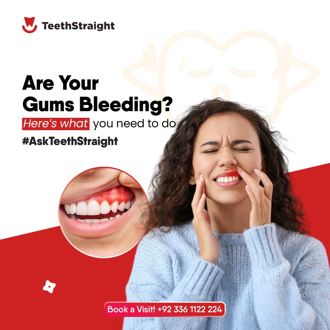 Are Your Gums Bleeding