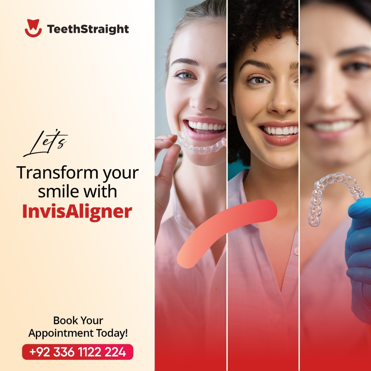 Best Teeth Clear Aligners