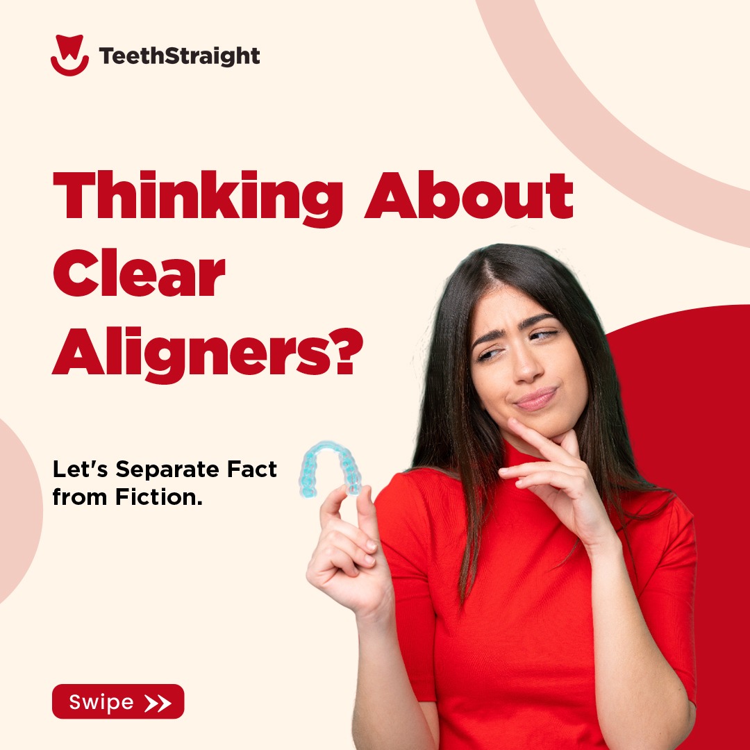Thinking about Clear Aligners