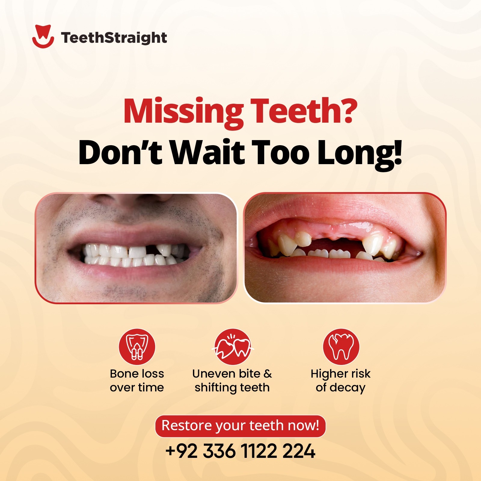 Restore your Teeth at Teeth Straight